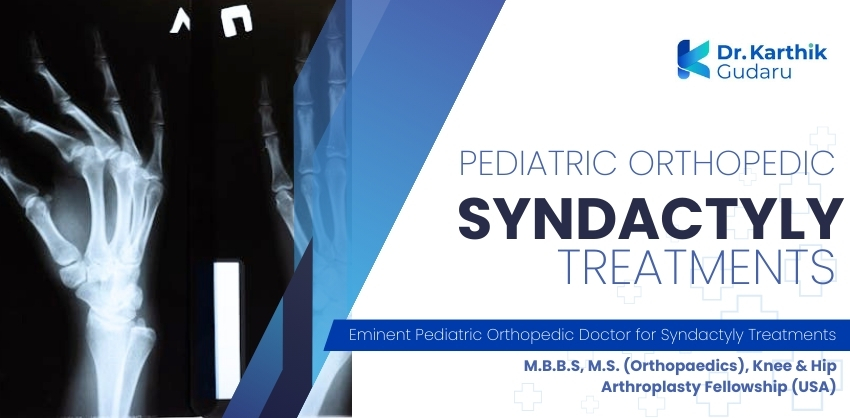 Orthopaedic doctor for Syndactyly Treatment for Children treatment in Telangana Dr Karthik Gudaru